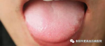 舌苔如果有这6个“异常”，可能是..